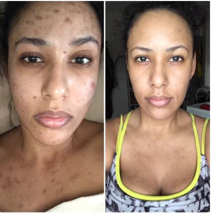 Clean Girl's LED Face Mask